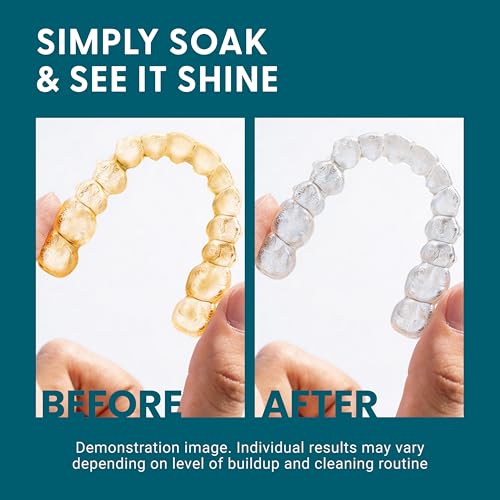 Retainer Cleaner and Soak Container, No-Mess Cleaning Tablets with Universal Denture Bath Case and Strainer, Multipurpose, for Mouth Guard Stains, Odor, and Plaque (92 Tablets + 1 Bath) by M3 - size: Dental Cleaning Kit (1 Count)