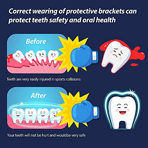 Youth Mouth Guard Football Sport Mouthguard, Premium Quality No Boiling Required，Suitable for Basketball, Wrestling, Taekwondo, Jujitsu and Karate - color: Purple