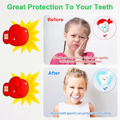 MENOLY 5 Packs Kids Mouth Guard - BPA Free Toddler Mouth Guard for Boys Girls with Portable Case, Mouth Guard Football for Boxing, Basketball, Lacrosse, MMA, Hockey, Wrestling, Soccer - size: Small (Under 7 Year old)