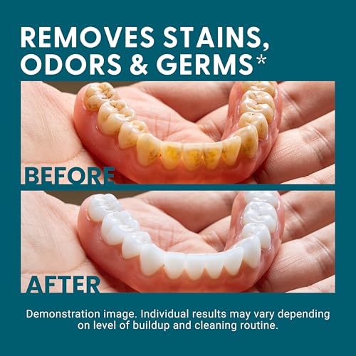 Denture Bath Case and Retainer Case, Denture Bath Cup for Invisalign Retainers Mouthguards Dentures Cleaner Kit with Strainer Spill-Free Portable Retainer Cleaner Case by M3 - size: Bath Case (1 Count)