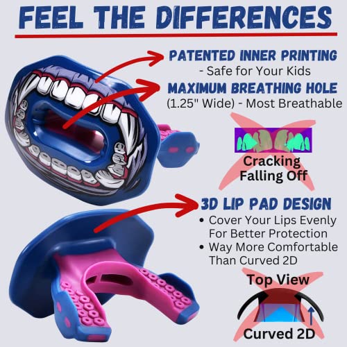 Oral Mart Flag Football Mouth Guard with 3D LipFit Design for Kids - Youth Football Mouthguard (No Boil) Cool Instant Fit Lip Guard Mouthpiece for Braces (Detachable Helmet Strap Included) - color: King Kong