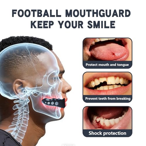 2 Pack Youth Football Mouth Guard with Strap and Case, Adults Sports Mouthguard Mouth Pieces for Football, Boxing, Basketball, Rugby, Hockey, Lacrosse, MMA, Wrestling, Soccer (Youth) - size: Youth