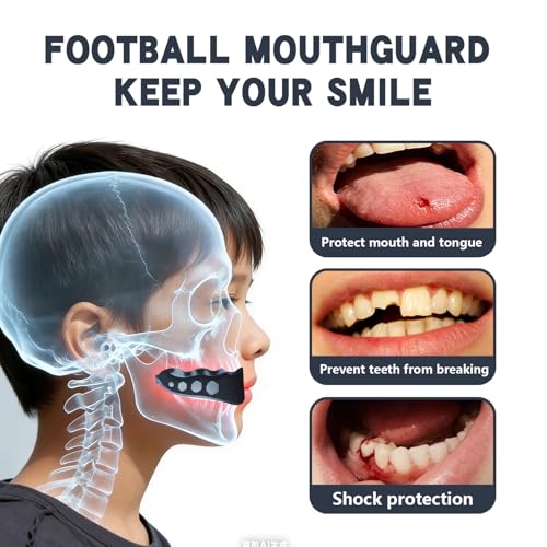 Shiseedl 2-Pack Football Mouth Guard Kids - Professional Kids Sports Mouthpiece with Strap & Case - 3-Layer Breathable Protection for Football, Basketball, MMA, Boxing - size: Kids